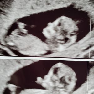 Meet your Posher, Shelly